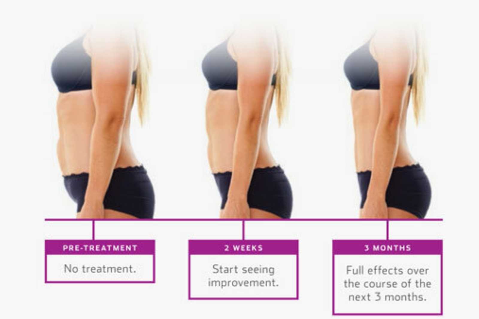 How to build wow! body contouring treatment plans - Body