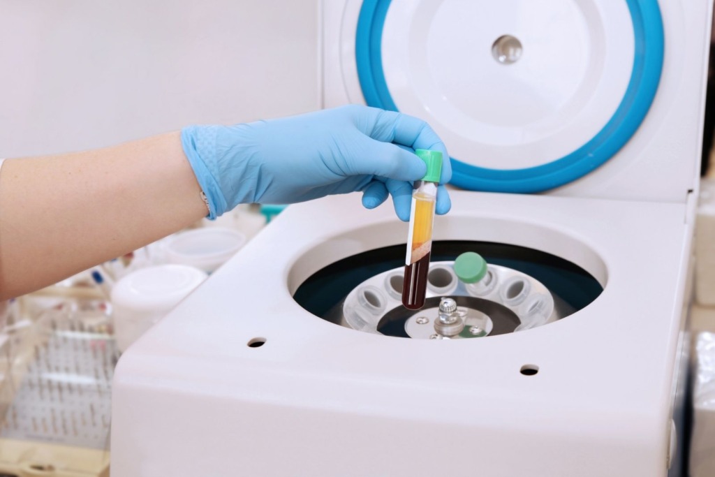 A gloved hand, reminiscent of the precision found in an aesthetics med spa, holds a test tube with a separated liquid over a centrifuge in Reno.