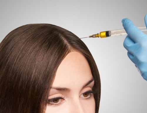 Are PRP Injections an Effective Solution for Hair Restoration?