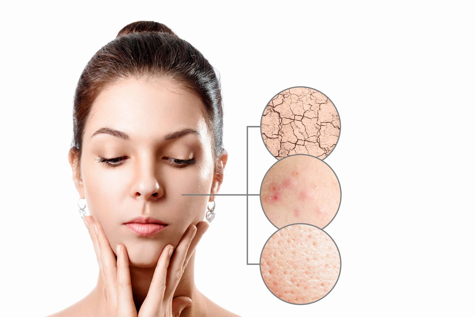 symptoms of dry skin