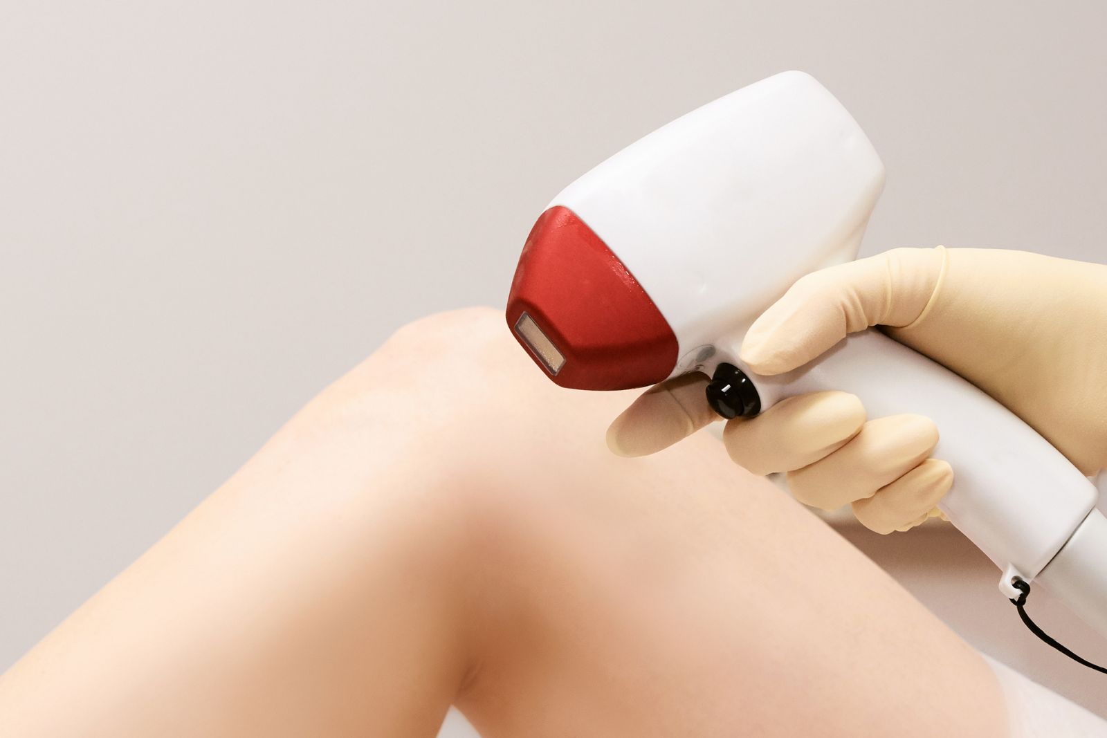 Intense Pulsed Light Laser Hair Removal Treatment
