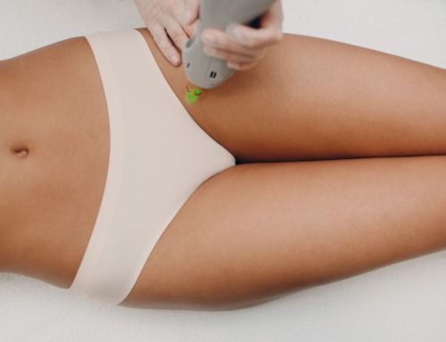 Achieve Flawless Confidence: A Deep Dive into Bikini Line Laser Hair Removal
