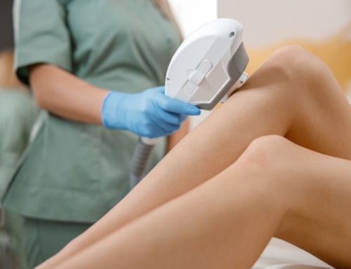 Wave Goodbye to Waxing: All About Permanent Hair Removal