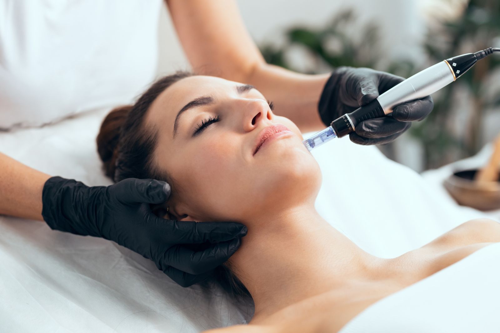 Aesthetician performs a microneedling treatment on the face of a relaxed female client in a clean, bright spa setting.