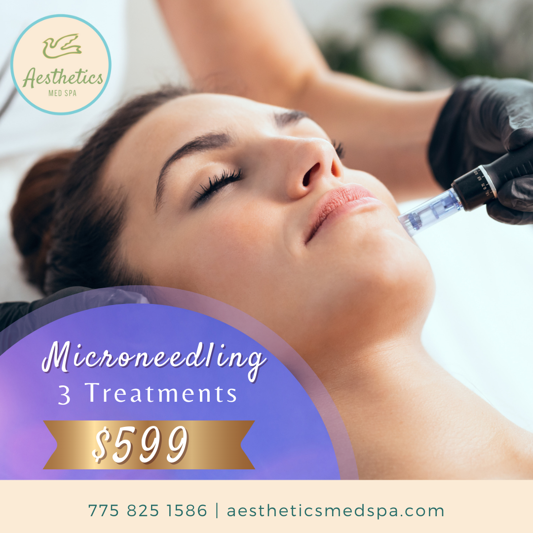 Aesthetic treatment offer: microneedling 3 treatments for $599.