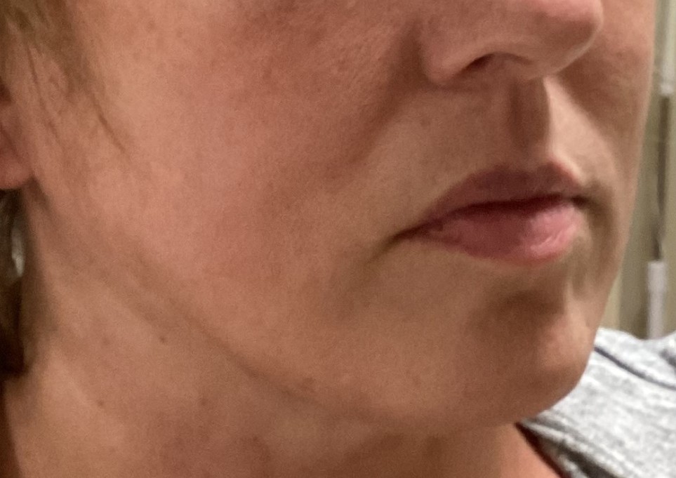 Close-up of a person's lower face, perfectly capturing the skin texture along with part of the chin and lips—an effortless portrayal reminiscent of an aesthetics med spa in Reno.