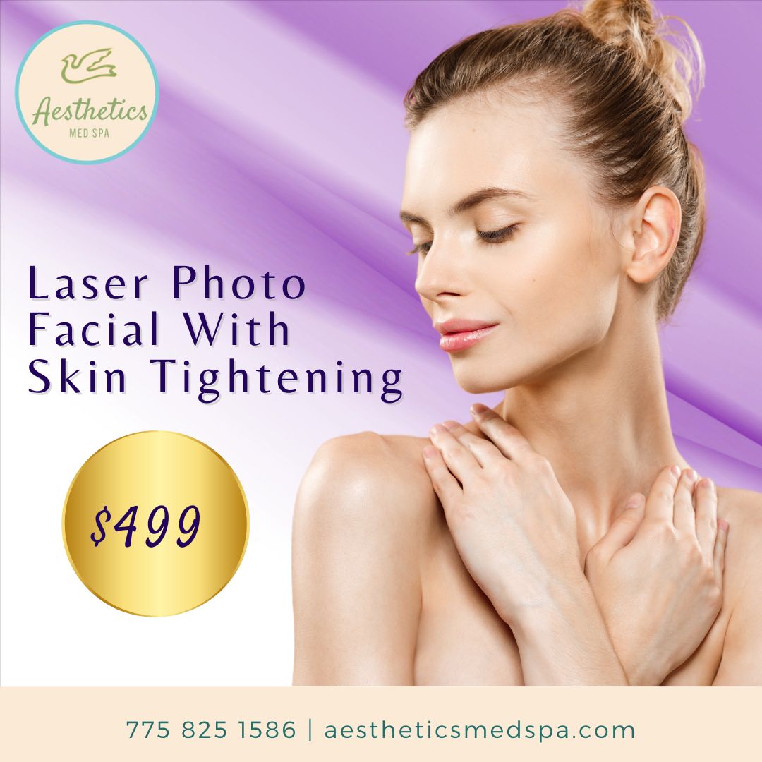 Woman with hands on chest in front of a purple background. Text reads "Laser Photo Facial With Skin Tightening" and "$499." Aesthetics Med Spa logo included. Located in Reno. Contact details at the bottom.