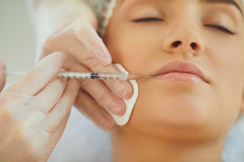 A person is receiving a cosmetic injection in the lips. An individual wearing gloves, who is experienced with various types of dermal fillers, holds a syringe and a cotton pad on the patient's face.