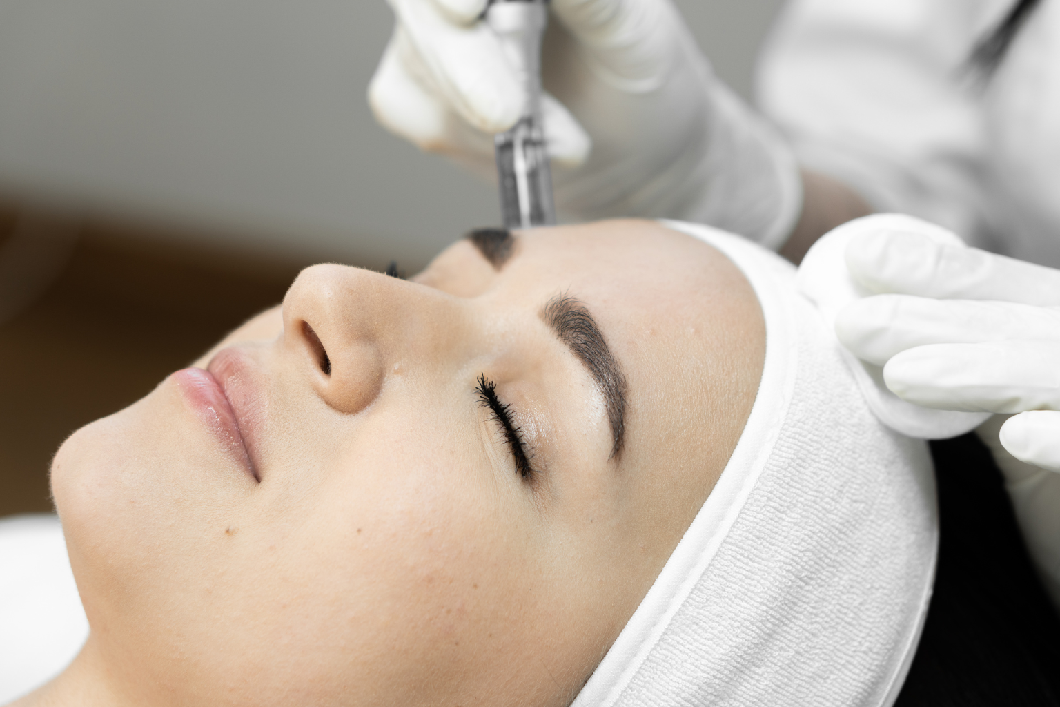 Person lying down with eyes closed, receiving a facial treatment with a microneedling pen, wearing a white headband. Hands in gloves are holding the device.