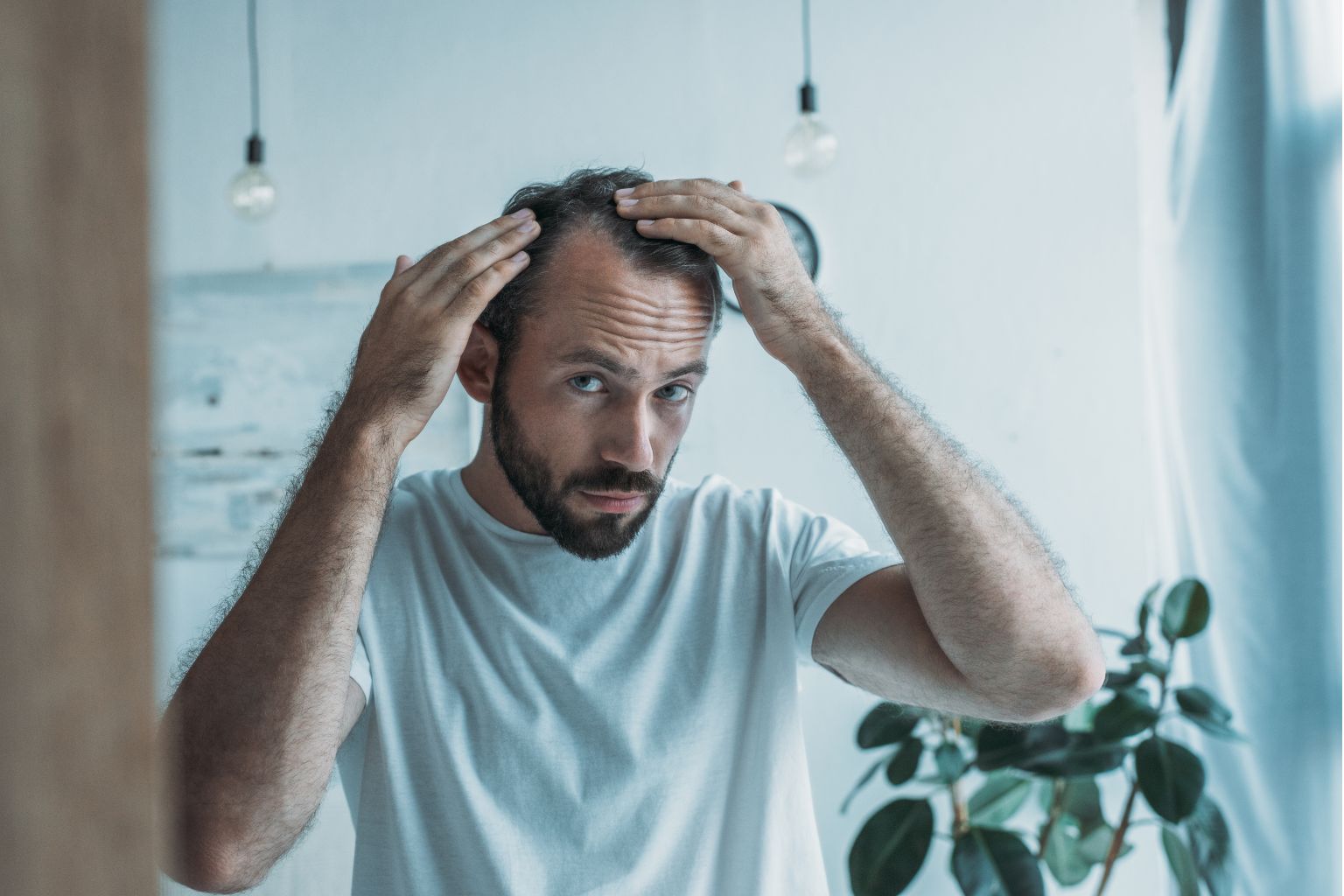 A man in a white shirt examines his hairline in a bright room with hanging light bulbs and a plant, contemplating microneedling for hair loss as a potential solution.