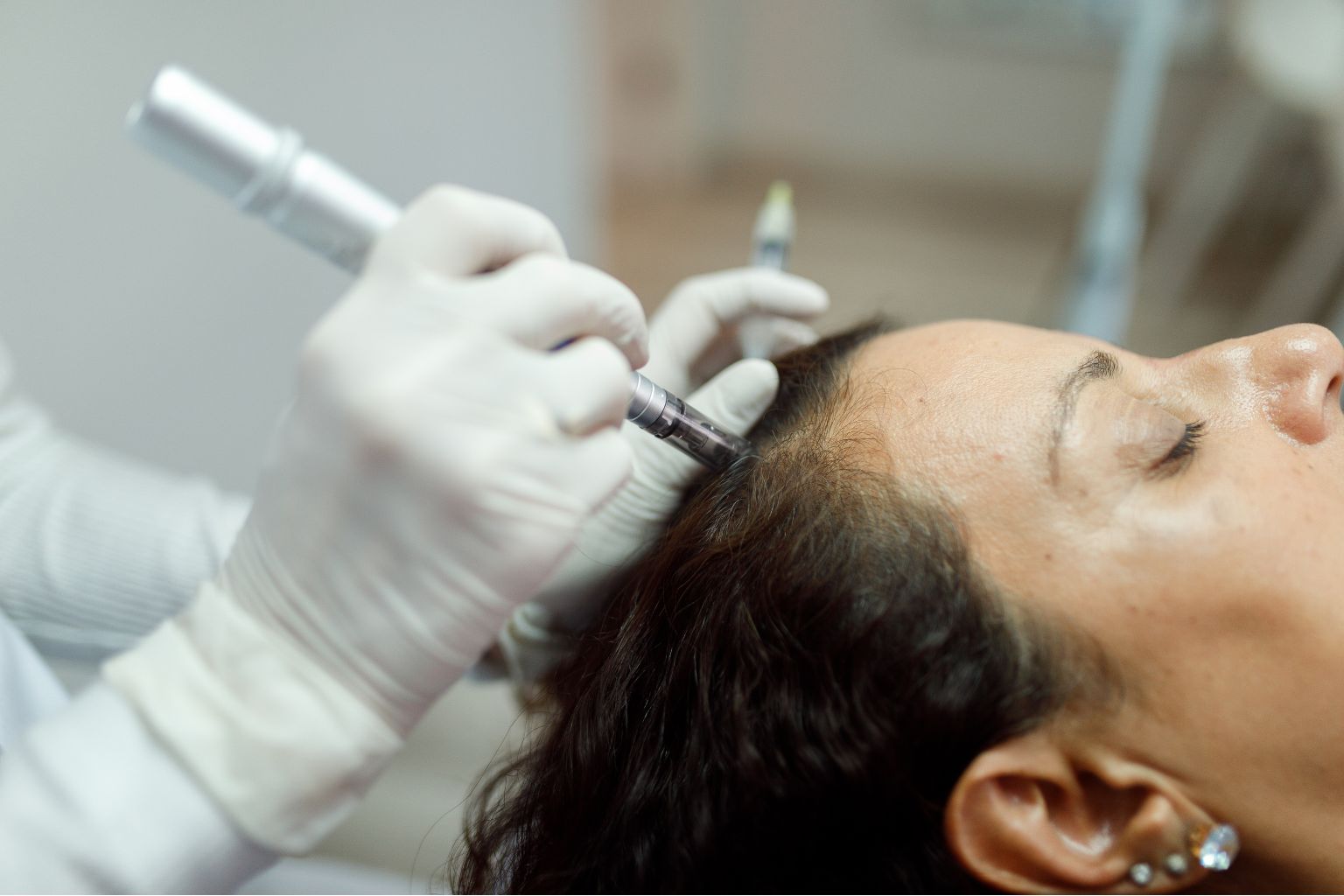 A person receives a microneedling scalp treatment with a handheld device. The practitioner, wearing gloves, focuses on an area near the forehead, enhancing hair growth through precise technique.