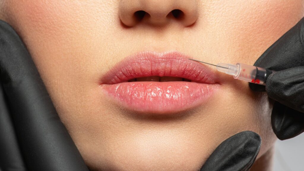 Close-up of a person's lips as a syringe is about to inject filler, with gloved hands holding the face, showcasing professional cosmetic services in Reno.