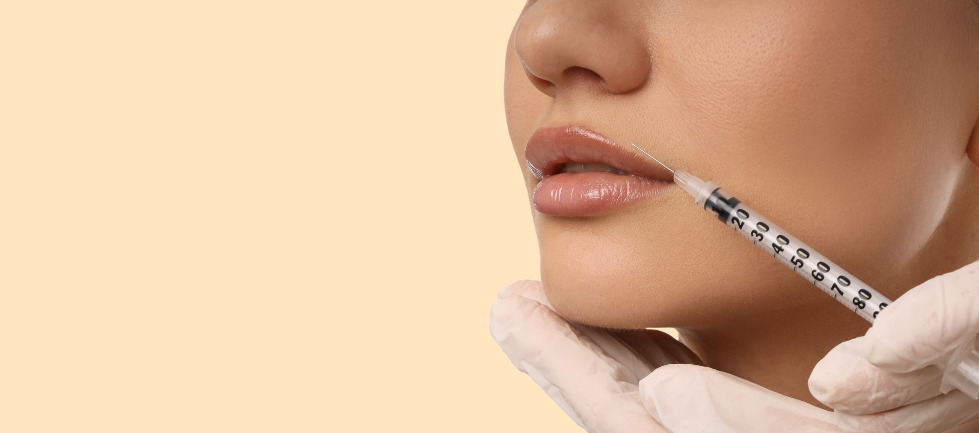 Close-up of a person receiving a lip injection with a syringe, performed by someone wearing white medical gloves, against a neutral background. This treatment is similar to procedures using the best filler for nasolabial folds, which help smooth smile lines and enhance overall facial contours.